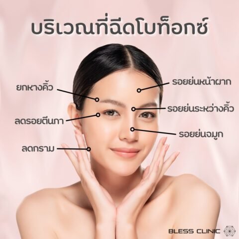 รีวิวฉีดโบท็อก โบท็อกหน้าเรียว