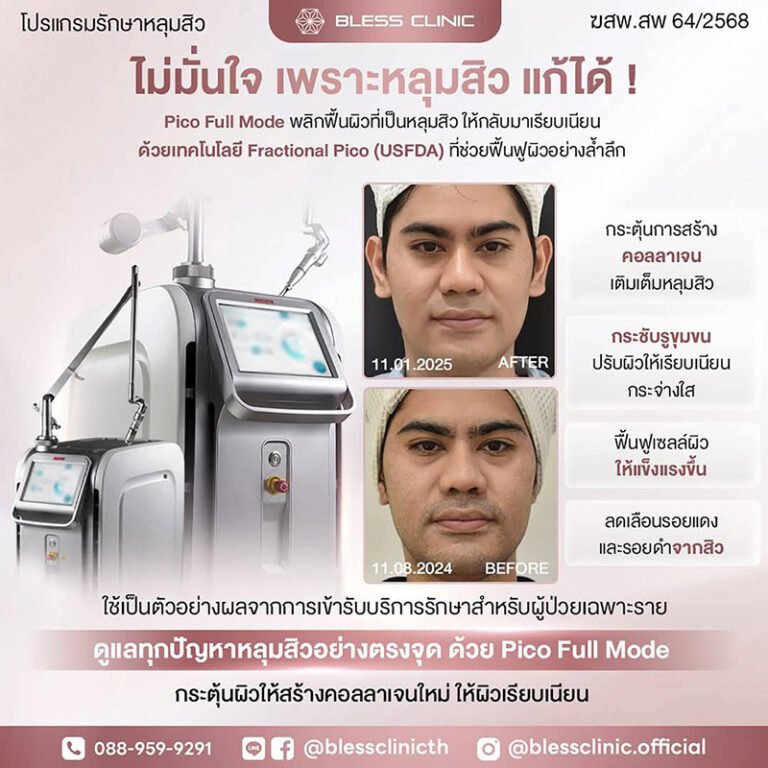 วิธีสังเกตสัญญาณผิวเสื่อมสภาพ