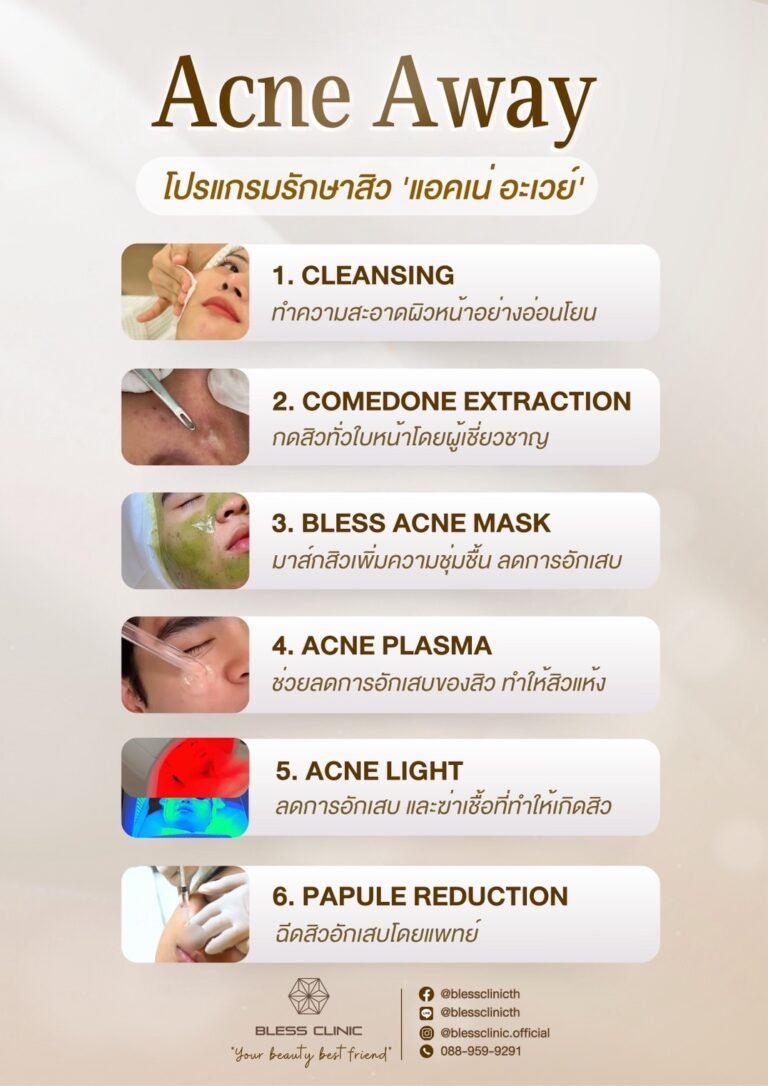 โปรแกรมรักษาสิว Acne Away