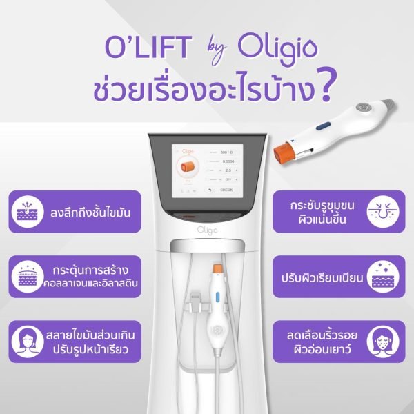 ปรแกรม Oligio เป็นเทคโนโลยี ยกกระชับผิวด้วยคลื่นวิทยุ (RF: Radio Frequency)